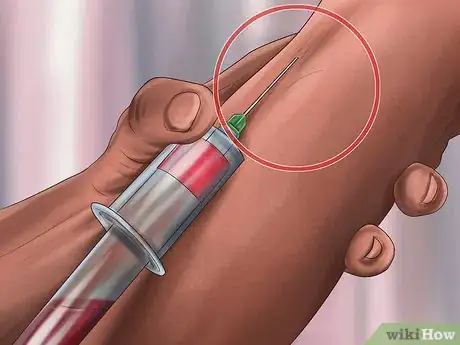 Image titled Calculate LDL Cholesterol Step 4
