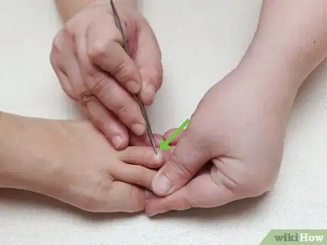 Image titled Give Someone a Pedicure Step 2