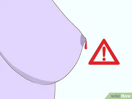 Image titled Diagnose Breast Cancer Step 4