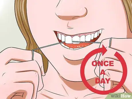 Image titled Keep from Having White Spots when Your Braces Come Off Step 4