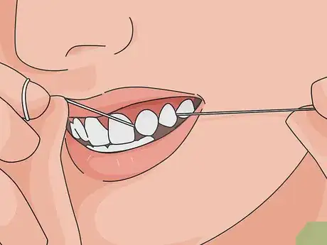 Image titled Deal with the Pain from a Chipped Tooth Step 4