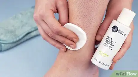 Image titled Treat Razor Bumps on Legs Step 9