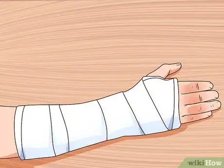 Image titled Apply Cold Therapy Step 11