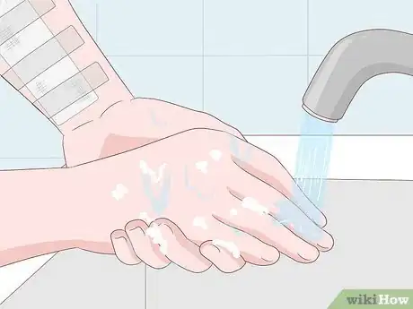 Image titled Prevent Surgical Site Infections Step 9