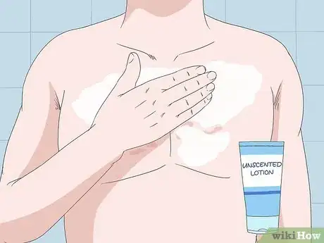 Image titled Avoid Triggers for Chronic Hives Step 17