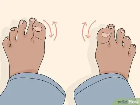 Image titled Diagnose and Treat a Tibial Plateau Fracture Step 05