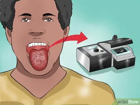 Image titled Deal With Dental Devices Step 22