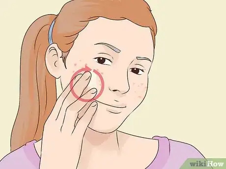 Image titled Make a Lemon Face Cleanser Step 5