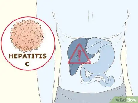 Image titled Evaluate Your Hepatitis C Risk Step 4