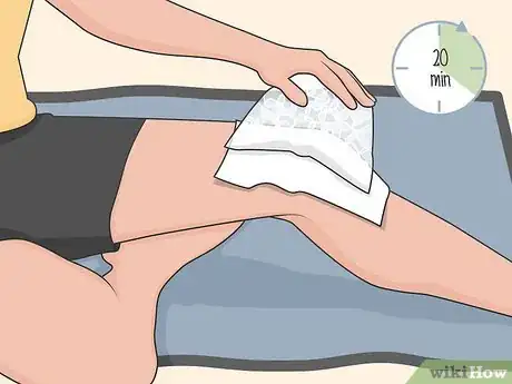 Image titled Diagnose and Treat a Tibial Plateau Fracture Step 10