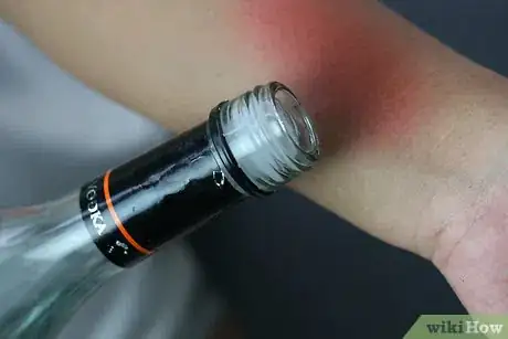 Image titled Soothe Bites and Stings with Vodka Step 10