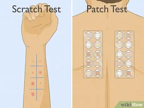 Image titled Patch Test Skin Step 1