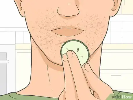 Image titled Get Rid of Razor Burn Fast Step 7