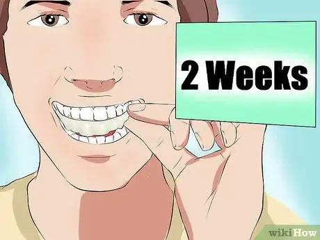 Image titled Deal With Dental Devices Step 12