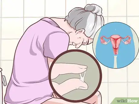 Image titled Reduce Your Gynecologic Cancer Risk Step 9