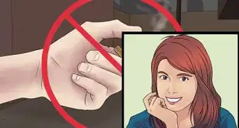 Get Rid of Cystic Acne Scars