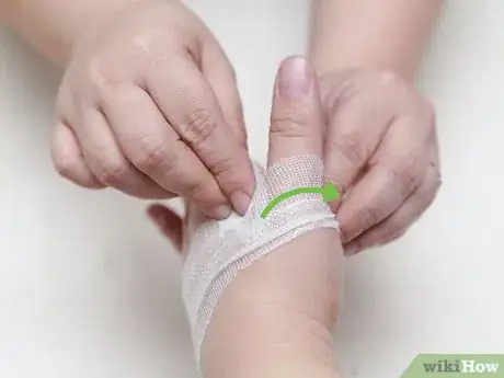 Image titled Strap a Thumb Step 8