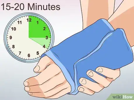 Image titled Avoid Rheumatoid Arthritis Remission Relapses Step 15