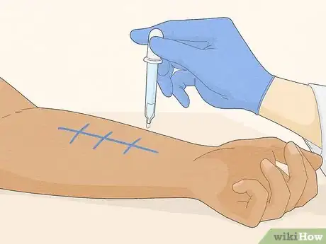 Image titled Patch Test Skin Step 3