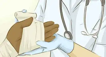 Use Aloe Vera to Treat Burns