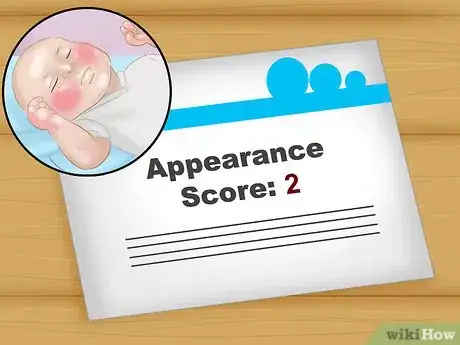 Image titled Read an APGAR Score Step 6