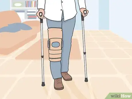 Image titled Diagnose and Treat a Tibial Plateau Fracture Step 12