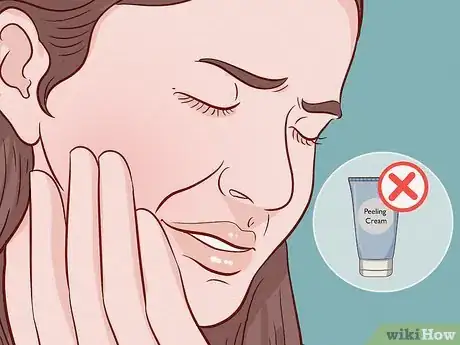 Image titled Apply the Skin Culture Peel Step 11