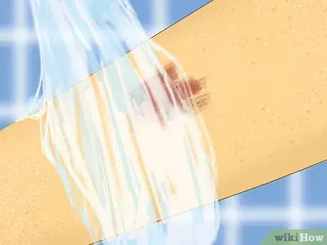 Image titled Care for Minor Abrasions and Scratches Step 3