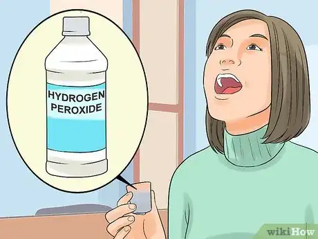 Image titled Stop Itchy Gums Step 4