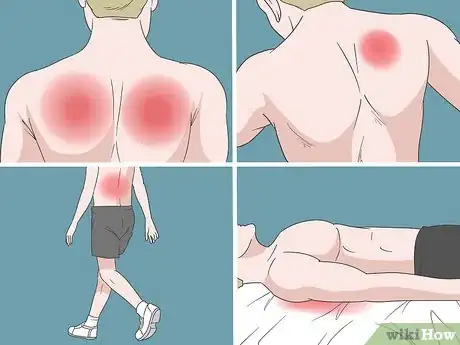 Image titled Alleviate Back Pain Naturally Step 16