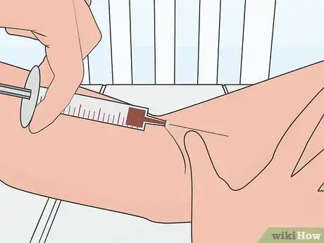 Image titled Test for M Protein Step 11