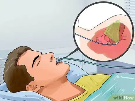 Image titled Find the Cause of Aortic Regurgitation Step 6