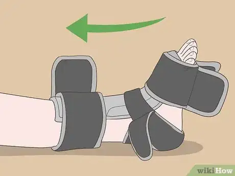 Image titled Wear a Dorsal Night Splint Step 3