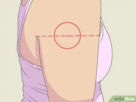 Image titled Treat Psoriasis with Biologics Step 6