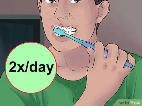 Image titled Avoid Getting Braces Step 8