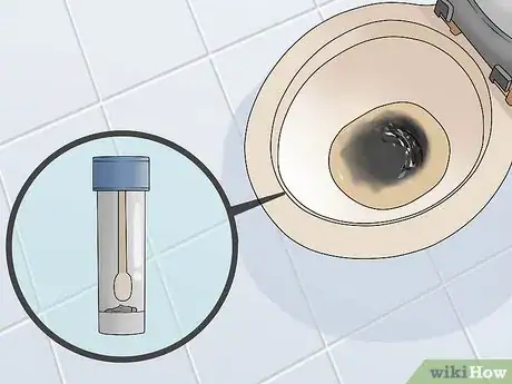 Image titled Test for Upper Gastrointestinal Bleeding Step 3