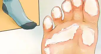 Get Rid of Dry Skin on Feet