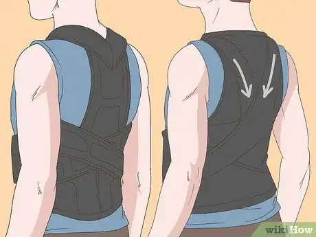 Image titled Diagnose and Treat a Pinched Nerve in Your Back Step 7