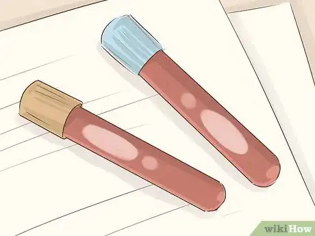 Image titled Get Tested for Allergies Step 11