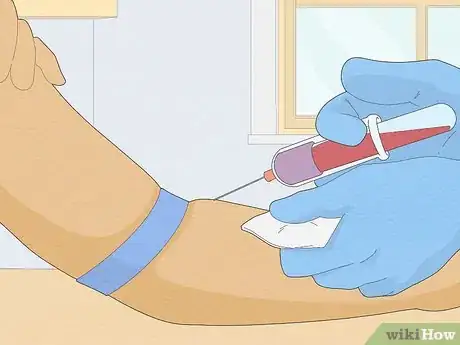 Image titled Recognize Hepatitis A Symptoms Step 9