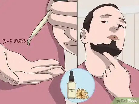 Image titled Reduce Beard Itch Step 8