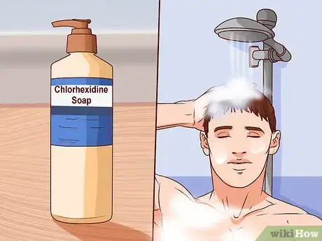 Image titled Reduce the Risk of Hospital Spread Infections Step 4