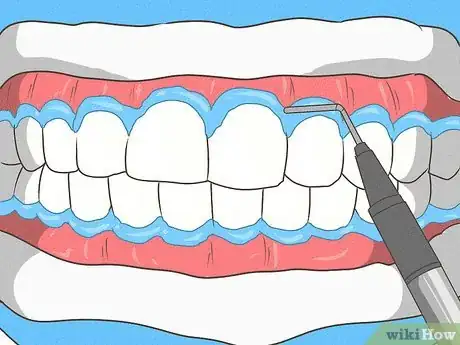 Image titled Avoid Hurting Your Gums Step 1