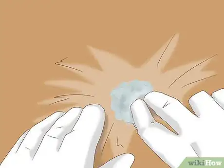 Image titled Remove Ticks from Furry Pets Step 9