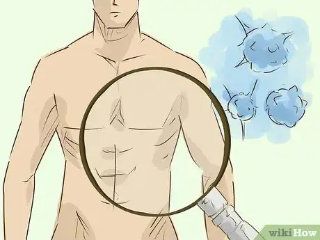 Image titled Diagnose Liver Cancer Step 17