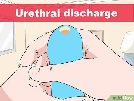 Image titled Know if You Have Epididymitis Step 4