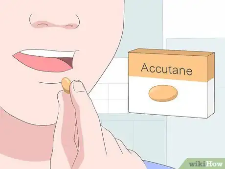 Image titled Cure Oily Skin Step 14