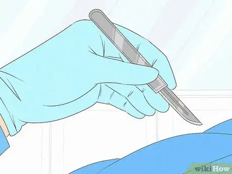 Image titled Diagnose Laryngopharyngeal Reflux Step 15