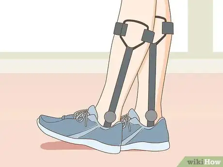 Image titled Fix Knock Knees Step 17