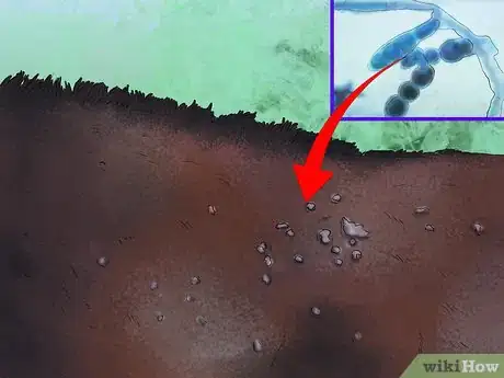 Image titled Treat Skin Disorders in Horses Step 6